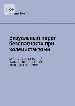 Визуальный порог безопасности при холецистэктоми. Культура безопасной лапароскопической холецистэктомии