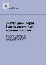 Визуальный порог безопасности при холецистэктоми. Культура безопасной лапароскопической холецистэктомии