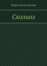 Сколиоз